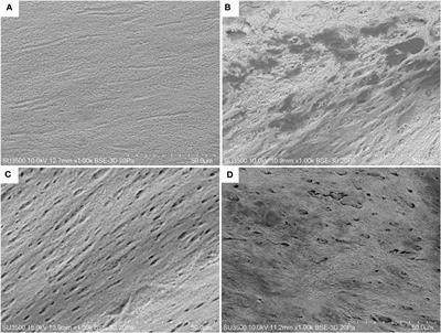 Osteogenic and microstructural characterization in normal versus deformed jaws of rainbow trout (Oncorhynchus mykiss) from freshwater